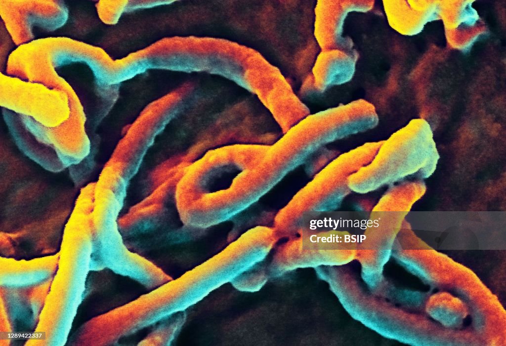 Ebola virus