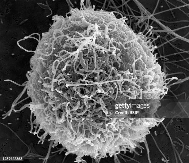 Scanning electron micrograph of filamentous Ebola virus particles budding from a single chronically-infected VERO E6 cell . Image captured at the...