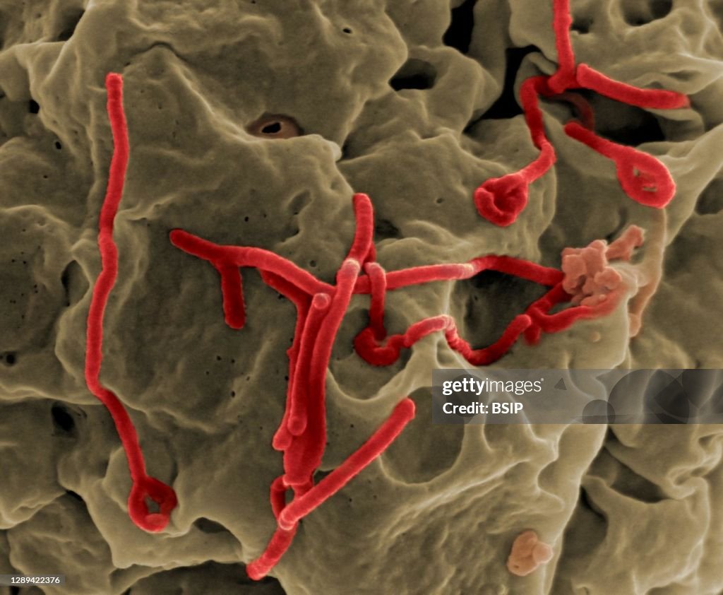 Ebola virus