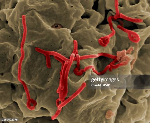 Scanning electron micrograph of Ebola virus budding from the surface of a Vero cell . Credit: NIAID.