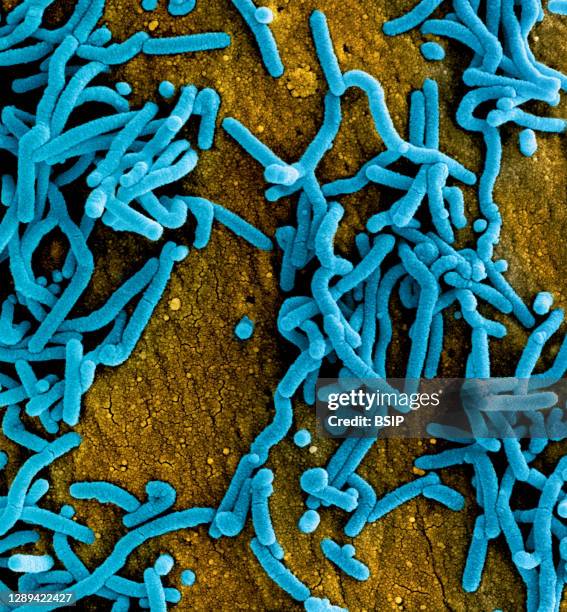 Colorized scanning electron micrograph of Marburg virus particles both budding and attached to the surface of infected VERO E6 cells . Image captured...