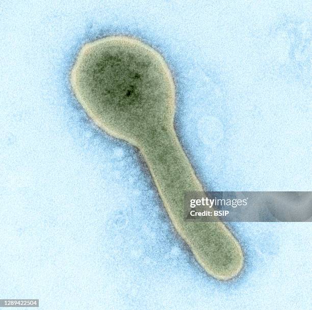 Colorized transmission electron micrograph of a Marburg virus particle harvested from infected VERO E6 cell supernatant. Image captured and...