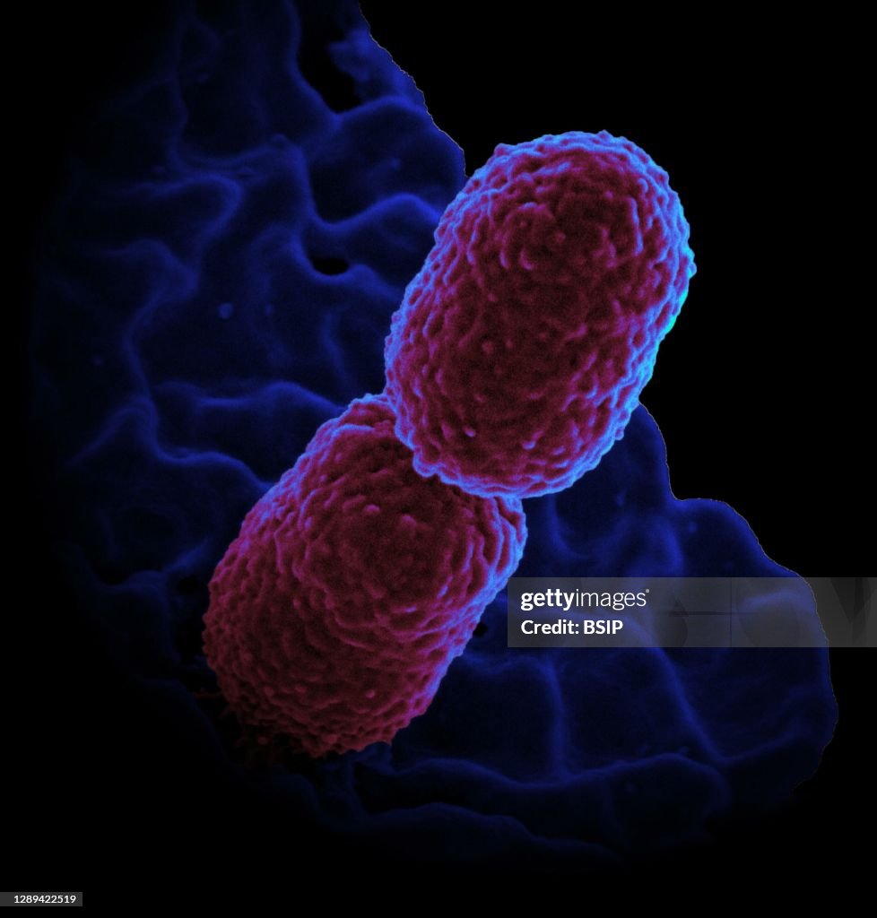 Klebsiella pneumoniae bacterium