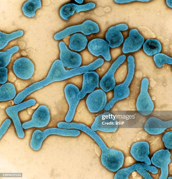 Colorized transmission electron micrograph of Marburg virus particles harvested from infected VERO E6 cell supernatant. Image captured and...