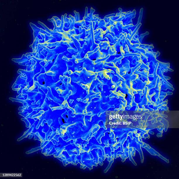 Scanning electron micrograph of a human T lymphocyte from the immune system of a healthy donor. Credit: NIAID.