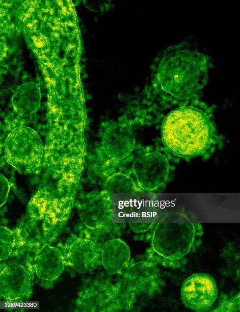 Colorized transmission electron micrograph showing particles of the Middle East respiratory syndrome coronavirus that emerged in 2012. Credit: NIAID.