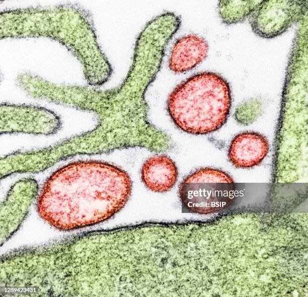 Colorized transmission electron micrograph of mature extracellular Nipah Virus particles near the periphery of an infected VERO cell . Image captured...