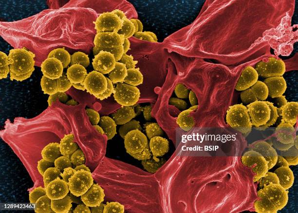 Scanning electron micrograph of methicillin-resistant Staphylococcus aureus and a dead human neutrophil. Credit: NIAID.