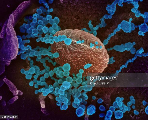 This scanning electron microscope image shows SARS-CoV-2 emerging from the surface of cells cultured in the lab. SARS-CoV-2, also known as 2019-nCoV,...