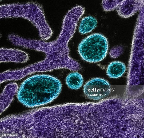 Colorized transmission electron micrograph of mature extracellular Nipah Virus particles near the periphery of an infected VERO cell . Image captured...