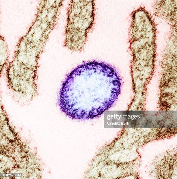 Colorized transmission electron micrograph of a mature extracellular Nipah Virus particle near the periphery of an infected VERO cell . Image...