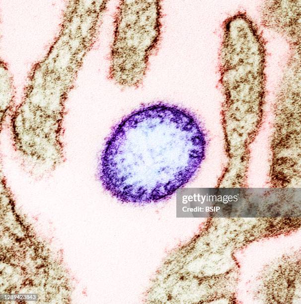 292 Nipah Virus Stock Photos High Res Pictures And Images Getty Images 292-nipah-virus-stock-photos-high-res-pictures-and-images-getty-images