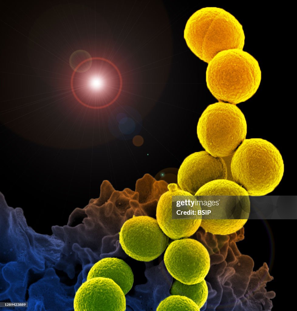 Methicillin-resistant staphylococcus aureus (mrsa)