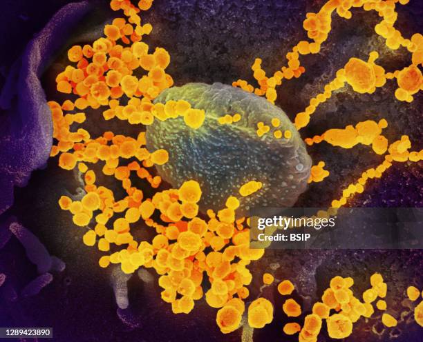 This scanning electron microscope image shows SARS-CoV-2 emerging from the surface of cells cultured in the lab. SARS-CoV-2, also known as 2019-nCoV,...