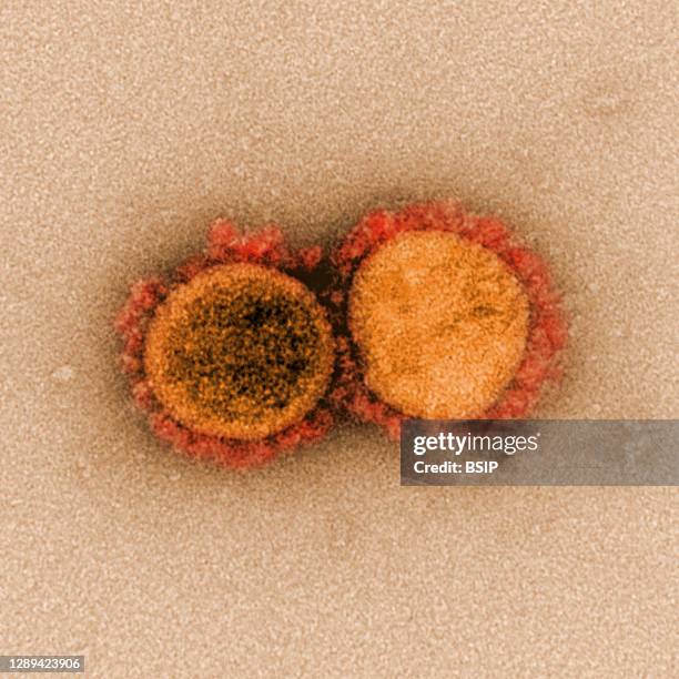 Transmission electron micrograph of SARS-CoV-2 virus particles, isolated from a patient. Image captured and color-enhanced at the NIAID Integrated...