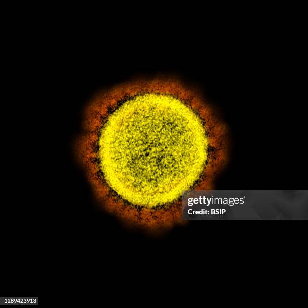 Transmission electron micrograph of SARS-CoV-2 virus particles, isolated from a patient. Image captured and color-enhanced at the NIAID Integrated...