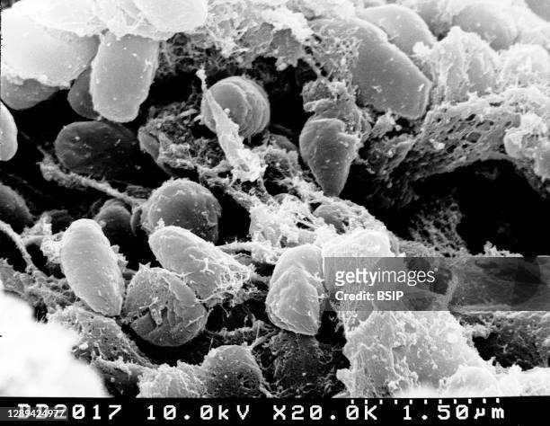 Scanning electron micrograph depicting a mass of Yersinia pestis bacteria in the foregut of the flea vector. Credit: NIAID.