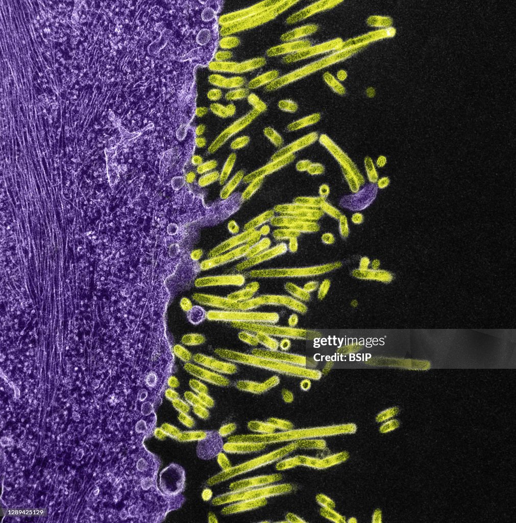 Swine flu virus particles
