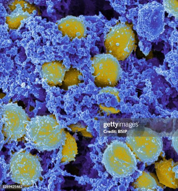 Scanning electromicrograph of Staphylococcus aureus bacteria. Credit: NIAID.