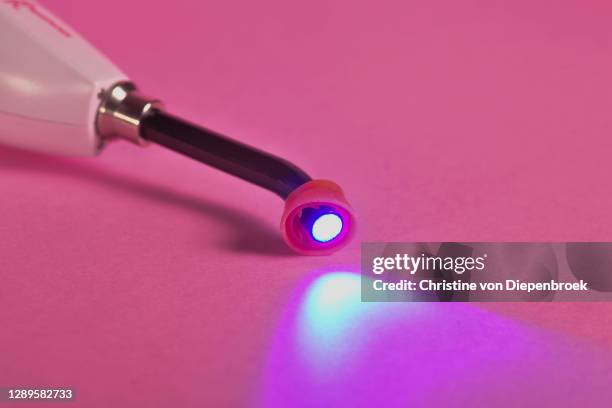 dental filling with uv-light - laser lights stock pictures, royalty-free photos & images