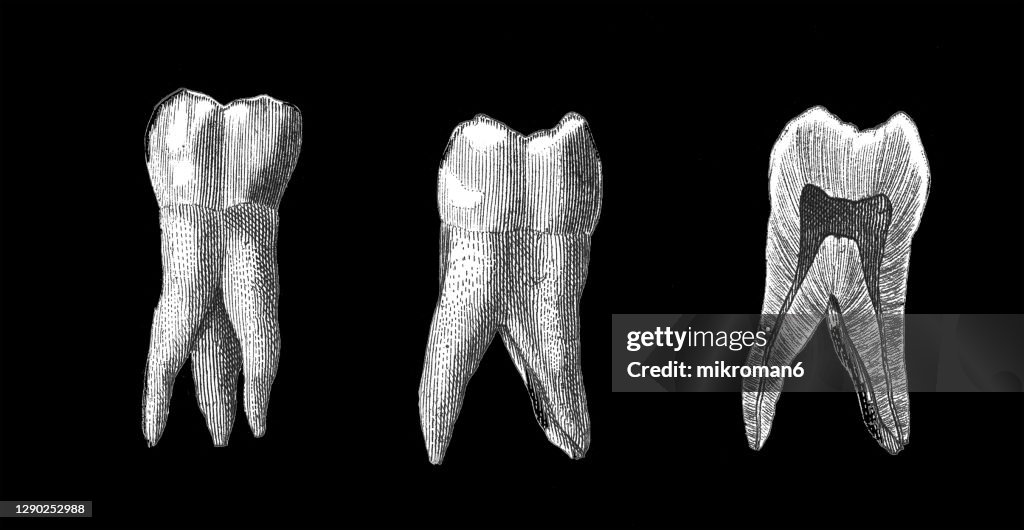 Molar Teeth Example Old Engraved Illustration Of Human Molars Teeth High-Res Stock Photo ...