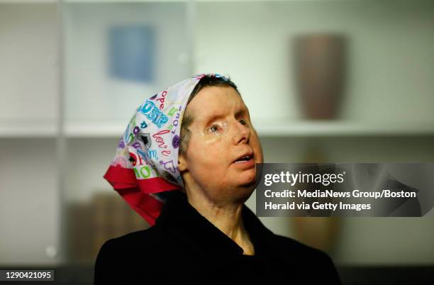Charla Nash, who was blinded, lost both hands and underwent a face transplant after being mauled by a neighbor's chimp in Connecticut in 2009, talks...