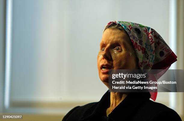 Charla Nash, who was blinded, lost both hands and underwent a face transplant after being mauled by a neighbor's chimp in Connecticut in 2009, talks...
