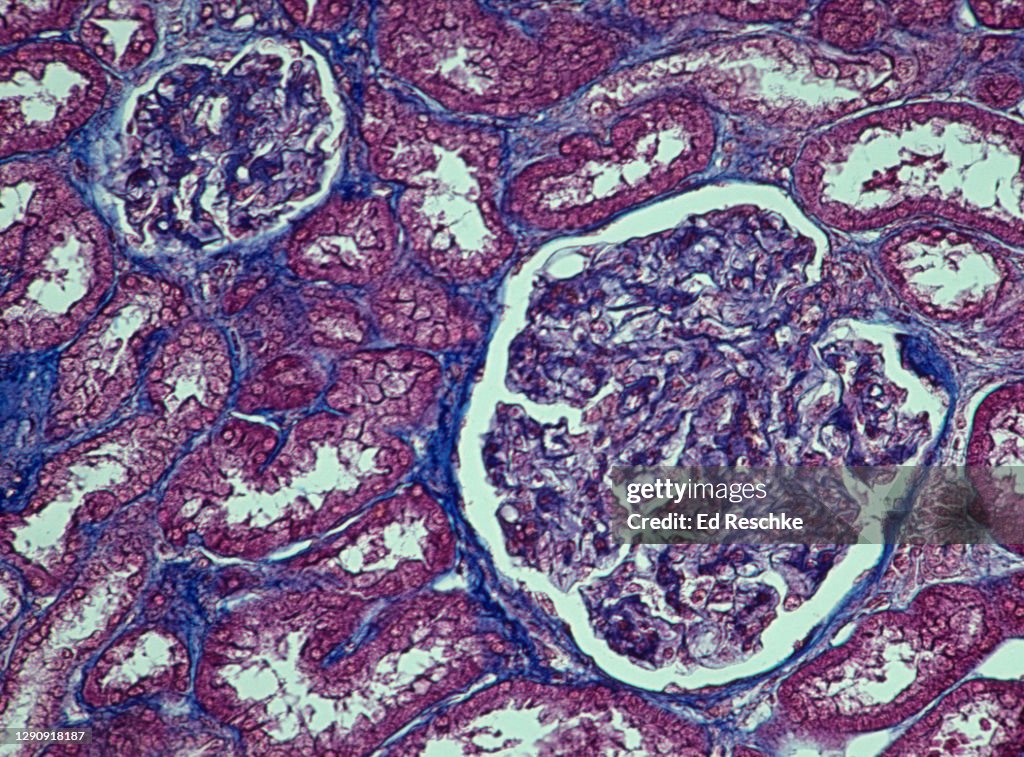 Two RENAL CORPUSCLES and RENAL TUBULES in a Human KIDNEY, 50X
