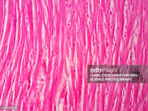 human cardiac muscle, light micrograph - myocardium stock-fotos und bilder