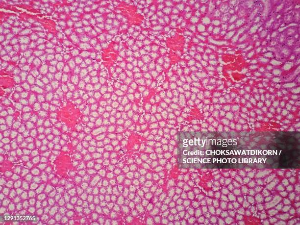 human kidney tissue, light micrograph - tissue anatomy stock pictures, royalty-free photos & images