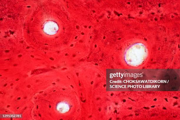 human compact bone tissue, light micrograph - lichtmikroskopische aufnahme stock-fotos und bilder