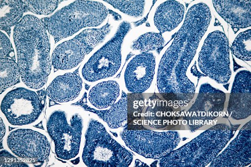 Human testis, light micrograph Human testis, light micrograph