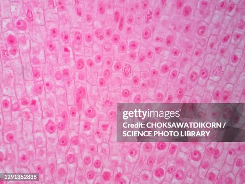 Plant root, light micrograph Plant root, light micrograph