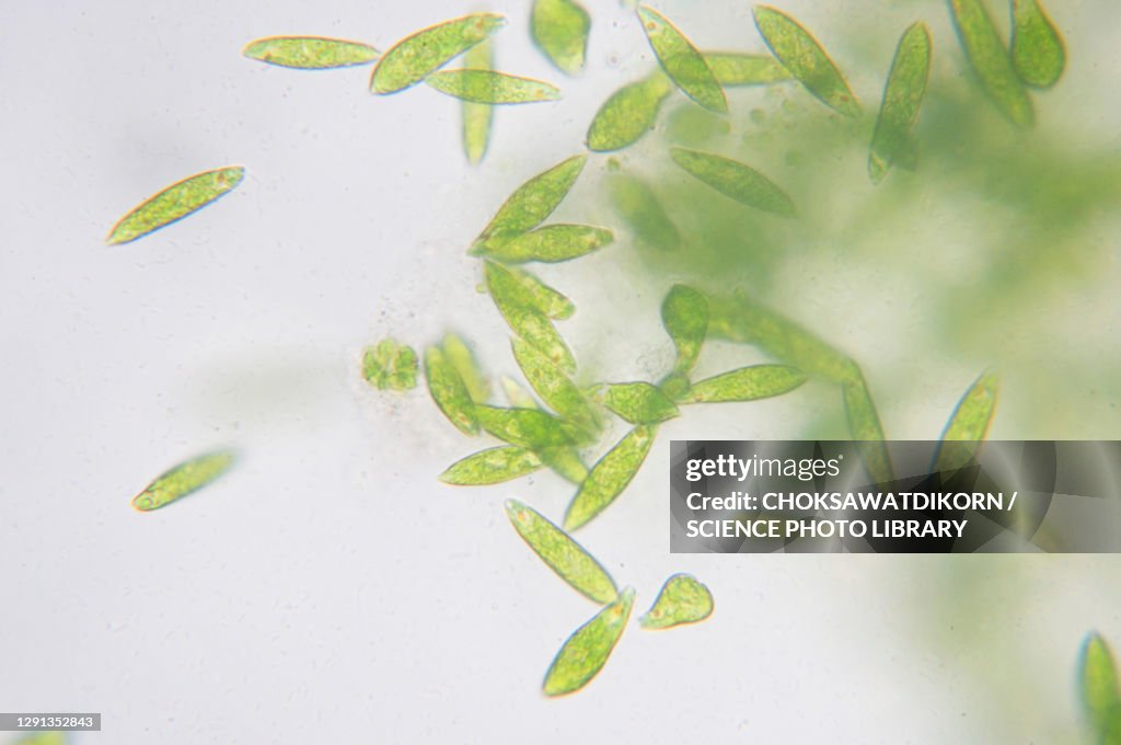 Euglena flagellate protozoans, light micrograph