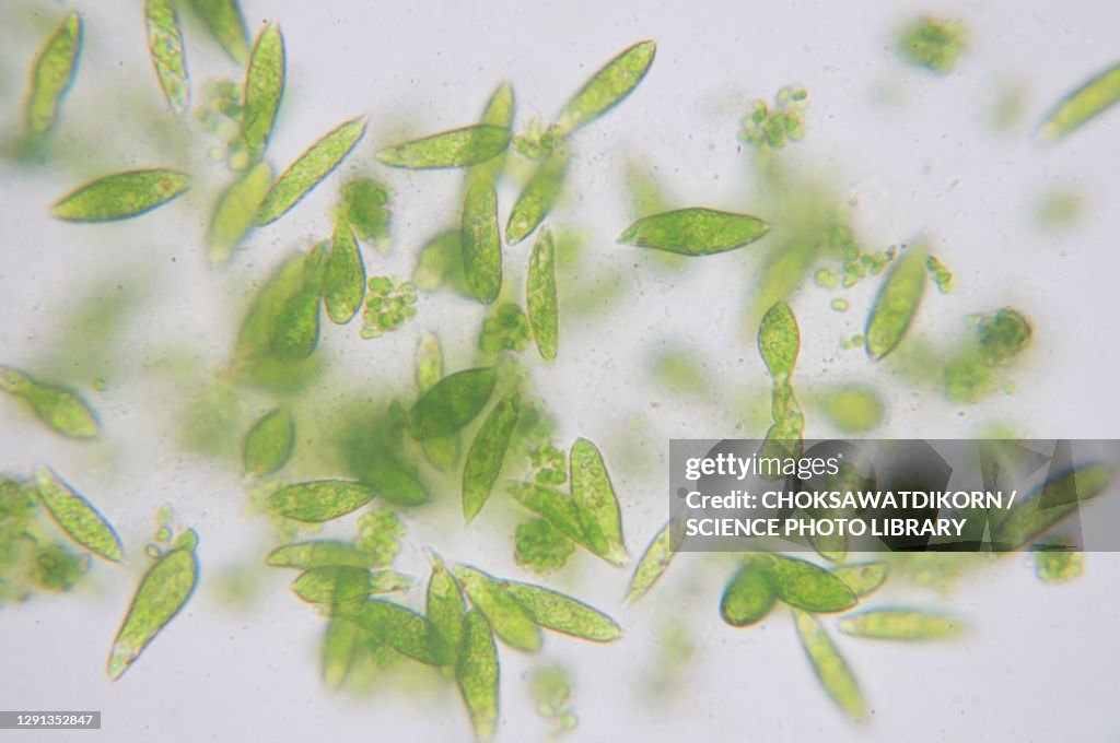 Euglena flagellate protozoans, light micrograph