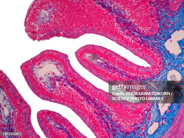 human intestine tissue, light micrograph - lichtmikroskopische aufnahme stock-fotos und bilder