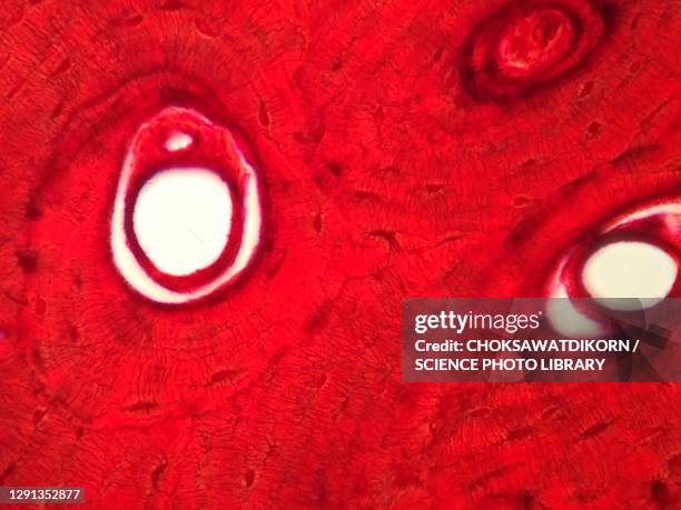 human compact bone tissue, light micrograph - light micrograph stock-fotos und bilder