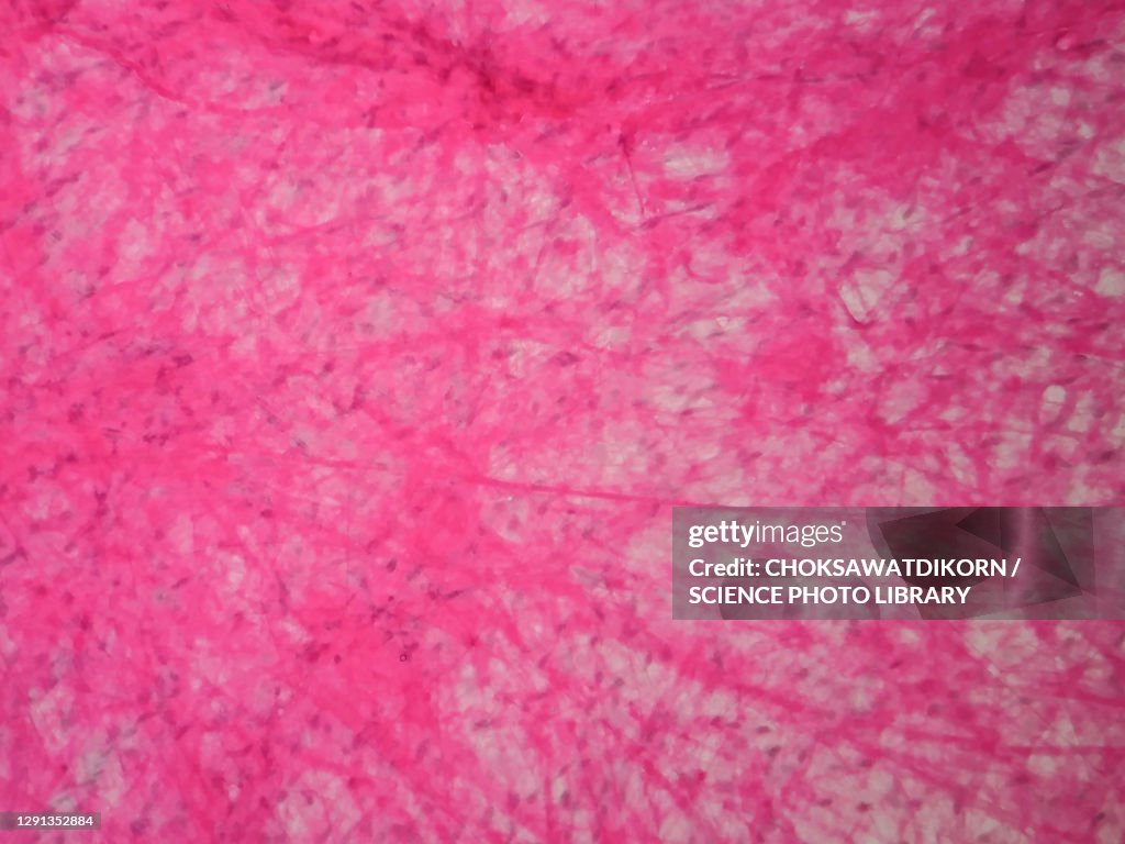 Human areolar tissue, light micrograph