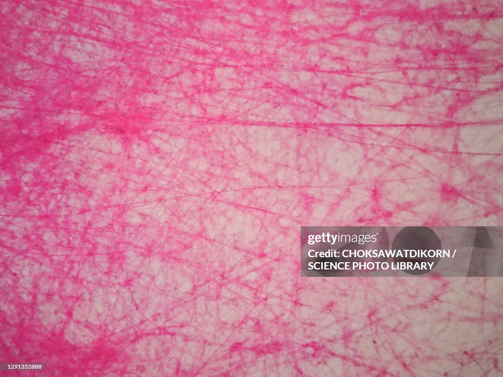 Human areolar tissue, light micrograph