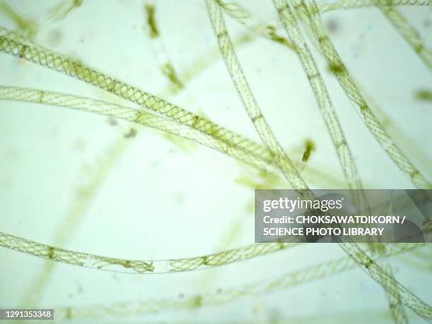 filamentous algae, light micrograph - algue verte photos et images de collection