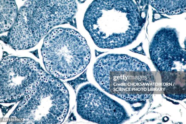 Small Testes Visual Testes Anatomy Photos and Premium High Res Pictures - Getty Images