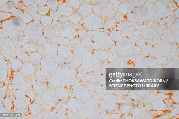 human fat cells, light micrograph - fettgewebezelle stock-fotos und bilder