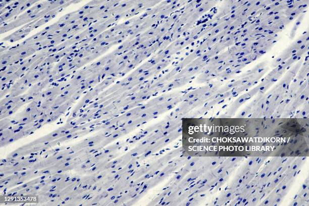 Michrograph 340 Cardiac Muscle Micrograph Stock Photos, High-Res Pictures, and ...