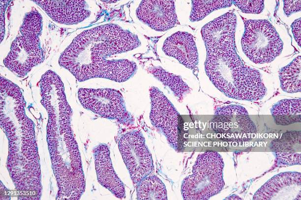 Small Testes Visual 840 Testes Anatomy Stock Photos, High-Res Pictures, and Images - Getty ...