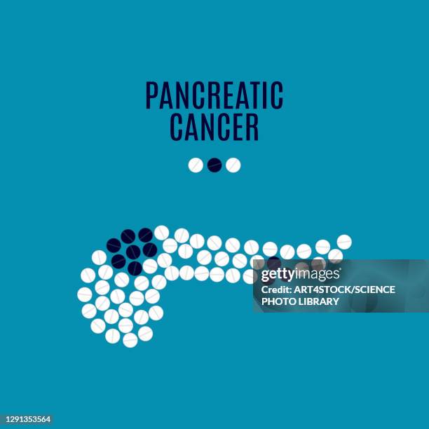 illustrazioni stock, clip art, cartoni animati e icone di tendenza di pancreatic cancer, conceptual illustration - tumore pancreas