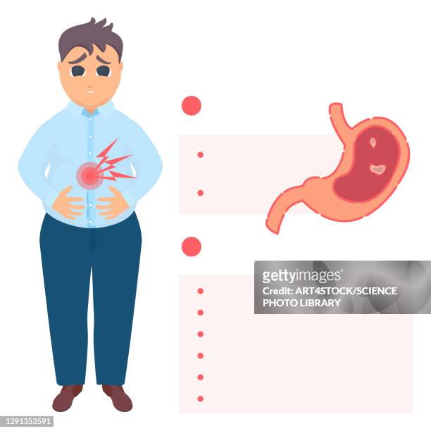 peptic ulcer, conceptual illustration - digestive system stock illustrations