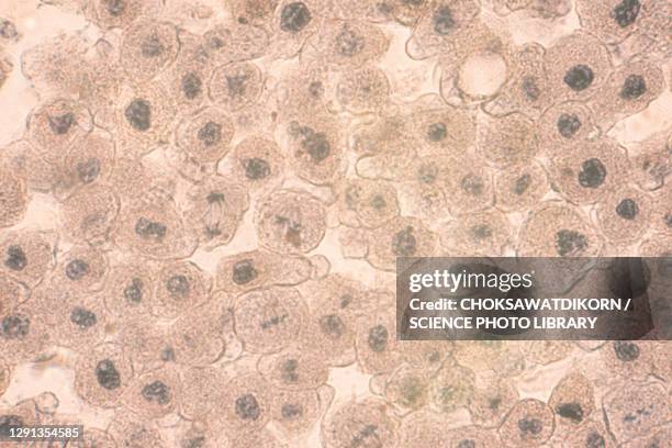 squamous epithelial cells, light micrograph - epitelio imagens e fotografias de stock