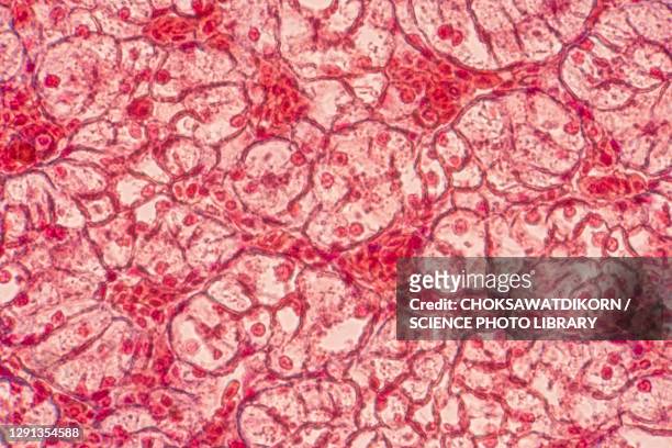 squamous epithelial cells, light micrograph - squamous epithelium stock pictures, royalty-free photos & images