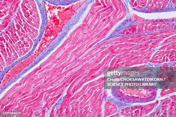 human cardiac muscle, light micrograph - myocardium stock-fotos und bilder