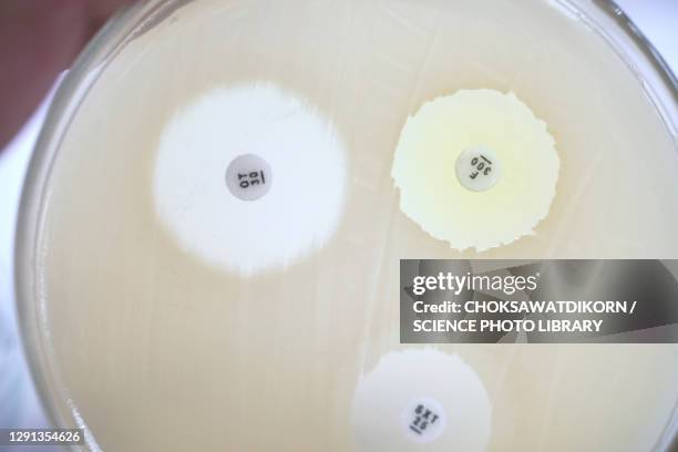 antibiotic sensitivity test - agar jelly stock pictures, royalty-free photos & images